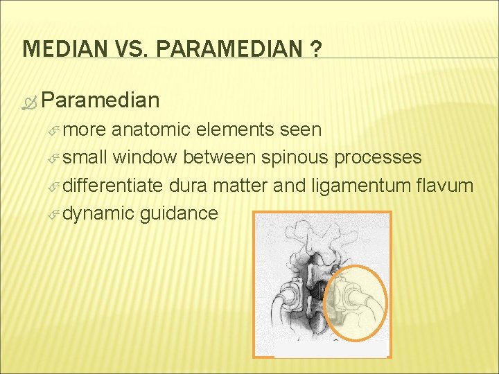 MEDIAN VS. PARAMEDIAN ? Paramedian more anatomic elements seen small window between spinous processes