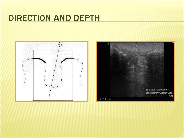 DIRECTION AND DEPTH 