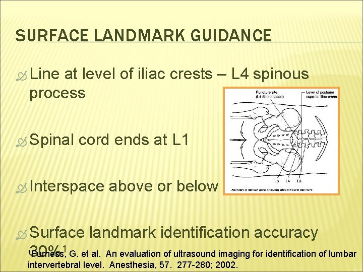 SURFACE LANDMARK GUIDANCE Line at level of iliac crests – L 4 spinous process