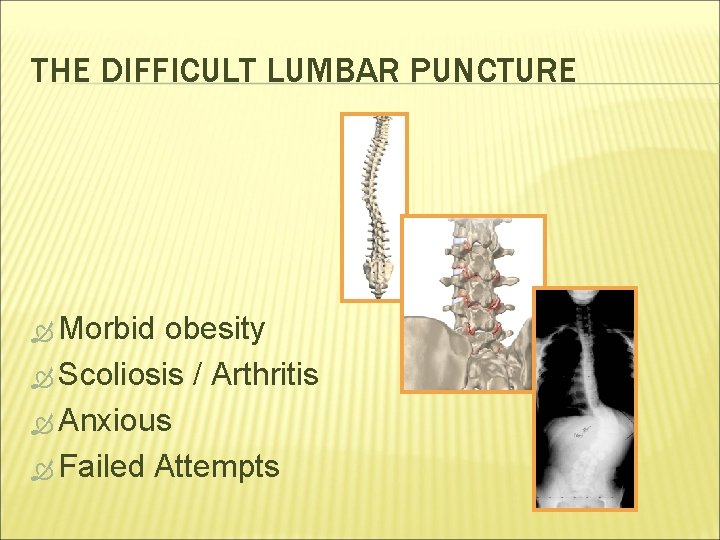 THE DIFFICULT LUMBAR PUNCTURE Morbid obesity Scoliosis / Arthritis Anxious Failed Attempts 