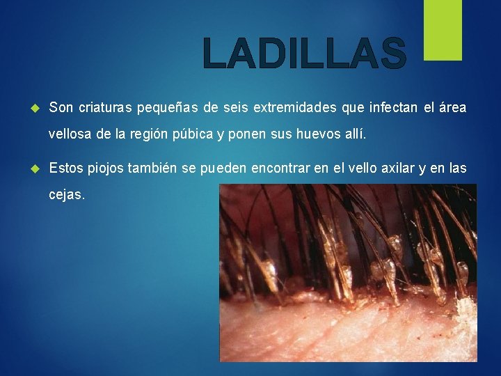 LADILLAS Son criaturas pequeñas de seis extremidades que infectan el área vellosa de la