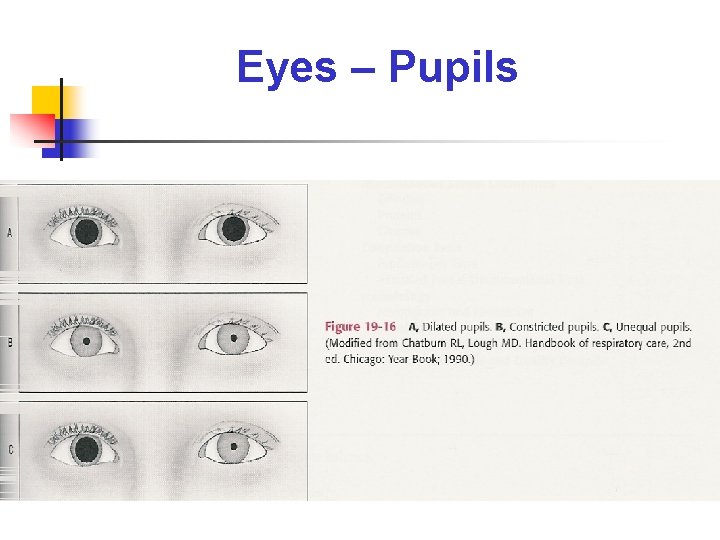 Eyes – Pupils 