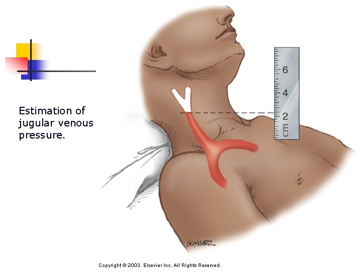 Estimation of jugular venous pressure. 