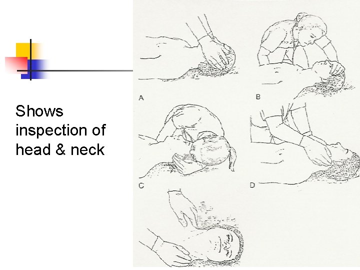 Shows inspection of head & neck 