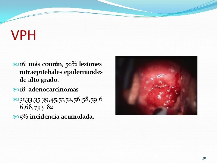 VPH 16: más común, 50% lesiones intraepiteliales epidermoides de alto grado. 18: adenocarcinomas 31, VPH 16: más común, 50% lesiones intraepiteliales epidermoides de alto grado. 18: adenocarcinomas 31,