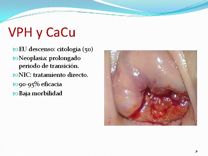 VPH y Ca. Cu EU descenso: citología (50) Neoplasia: prolongado periodo de transición. NIC: VPH y Ca. Cu EU descenso: citología (50) Neoplasia: prolongado periodo de transición. NIC: