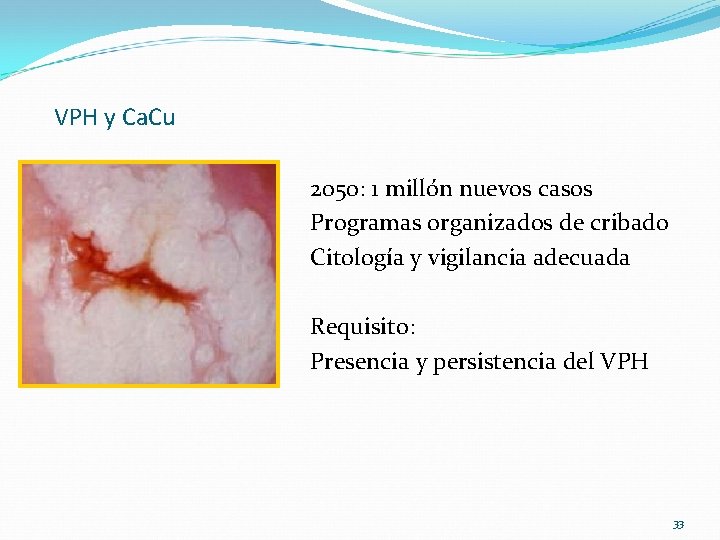 VPH y Ca. Cu 2050: 1 millón nuevos casos Programas organizados de cribado Citología VPH y Ca. Cu 2050: 1 millón nuevos casos Programas organizados de cribado Citología