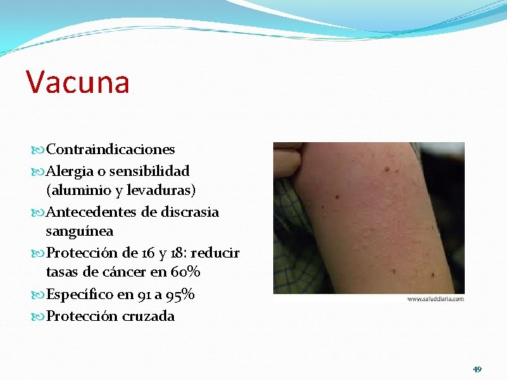 Vacuna Contraindicaciones Alergia o sensibilidad (aluminio y levaduras) Antecedentes de discrasia sanguínea Protección de Vacuna Contraindicaciones Alergia o sensibilidad (aluminio y levaduras) Antecedentes de discrasia sanguínea Protección de