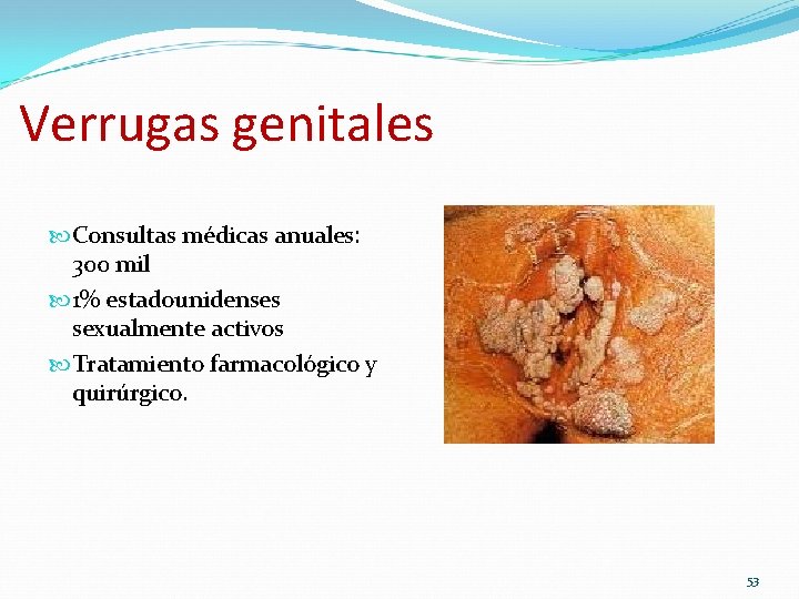 Verrugas genitales Consultas médicas anuales: 300 mil 1% estadounidenses sexualmente activos Tratamiento farmacológico y Verrugas genitales Consultas médicas anuales: 300 mil 1% estadounidenses sexualmente activos Tratamiento farmacológico y