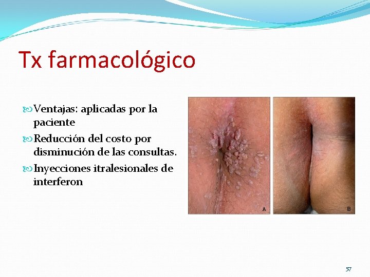 Tx farmacológico Ventajas: aplicadas por la paciente Reducción del costo por disminución de las Tx farmacológico Ventajas: aplicadas por la paciente Reducción del costo por disminución de las