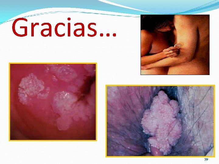 Gracias… 59 Gracias… 59