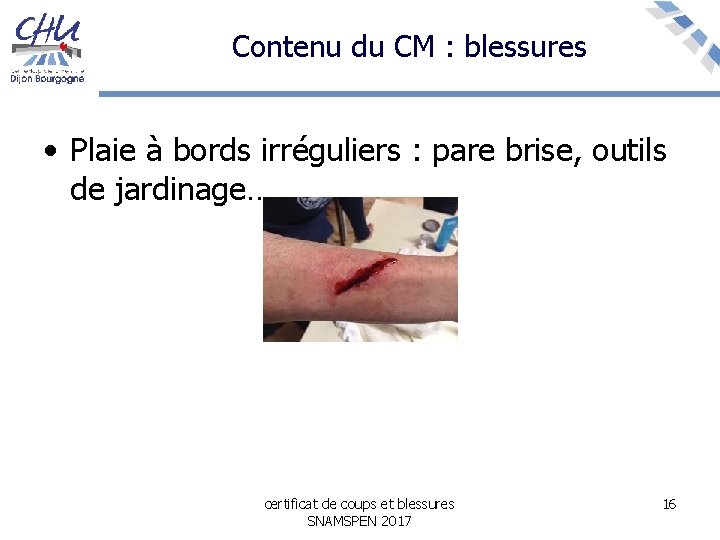 Contenu du CM : blessures • Plaie à bords irréguliers : pare brise, outils