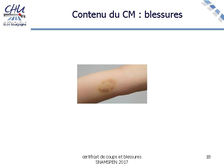 Contenu du CM : blessures certificat de coups et blessures SNAMSPEN 2017 18 