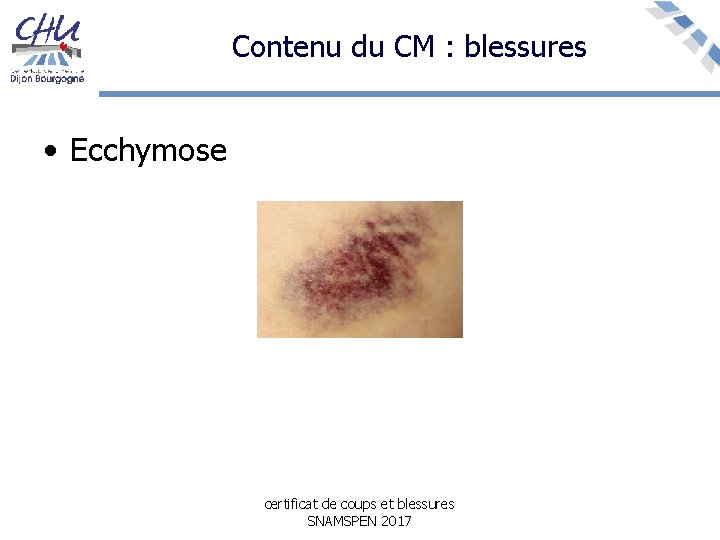 Contenu du CM : blessures • Ecchymose certificat de coups et blessures SNAMSPEN 2017
