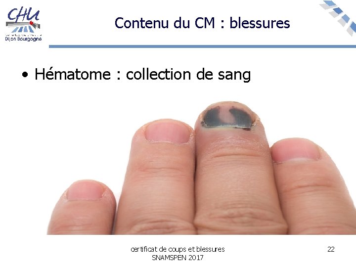 Contenu du CM : blessures • Hématome : collection de sang certificat de coups