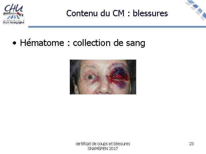 Contenu du CM : blessures • Hématome : collection de sang certificat de coups