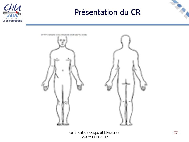 Présentation du CR certificat de coups et blessures SNAMSPEN 2017 27 