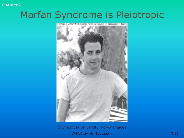 Chapter 3 Marfan Syndrome is Pleiotropic © Columbia University, ho/AP Images © Mc. Graw-Hill Chapter 3 Marfan Syndrome is Pleiotropic © Columbia University, ho/AP Images © Mc. Graw-Hill