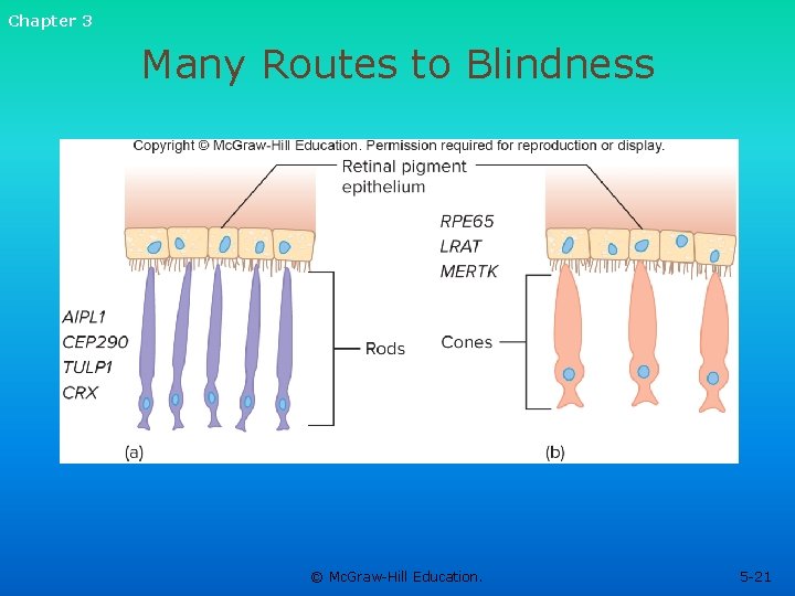 Chapter 3 Many Routes to Blindness © Mc. Graw-Hill Education. 5 -21 Chapter 3 Many Routes to Blindness © Mc. Graw-Hill Education. 5 -21