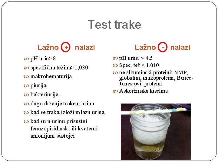 Test trake Lažno + nalazi p. H urin>8 specifična težina>1, 030 makrohematurija piurija bakteriurija