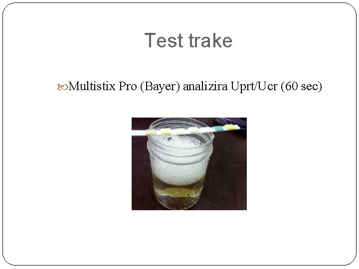 Test trake Multistix Pro (Bayer) analizira Uprt/Ucr (60 sec) 