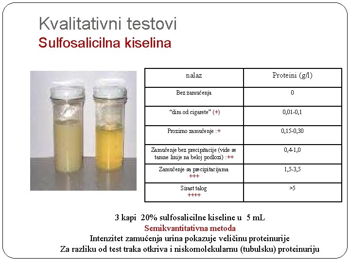 Kvalitativni testovi Sulfosalicilna kiselina nalaz Proteini (g/l) Bez zamućenja 0 “dim od cigarete” (+)