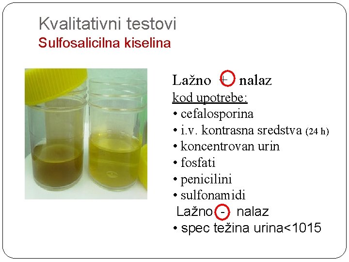 Kvalitativni testovi Sulfosalicilna kiselina Lažno + nalaz kod upotrebe: • cefalosporina • i. v.