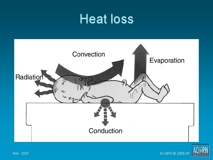 Heat loss Nov 2007 ACo. RN © 2005 -07 Heat loss Nov 2007 ACo. RN © 2005 -07