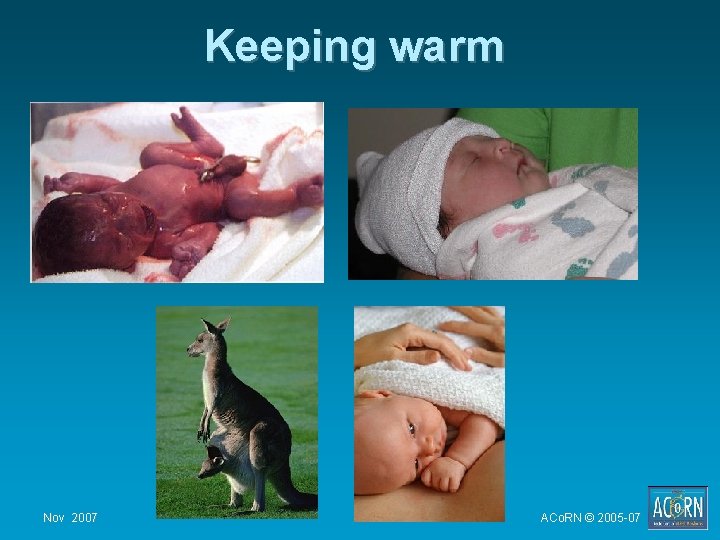 Keeping warm Nov 2007 ACo. RN © 2005 -07 Keeping warm Nov 2007 ACo. RN © 2005 -07