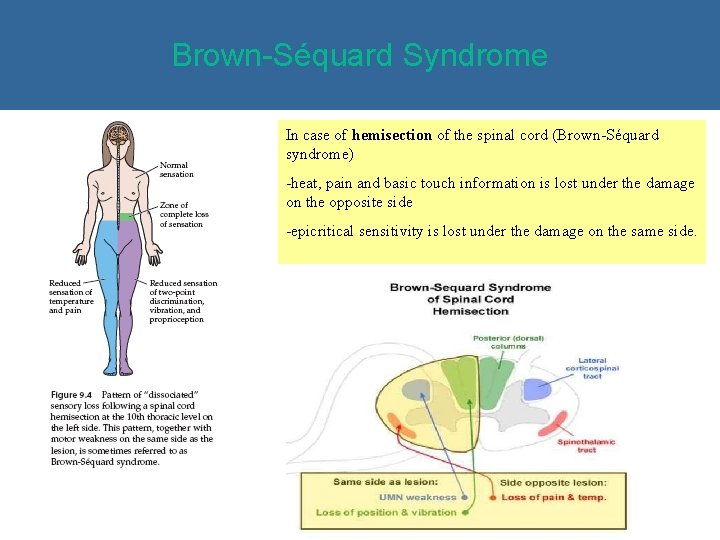 Brown-Séquard Syndrome In case of hemisection of the spinal cord (Brown-Séquard syndrome) -heat, pain