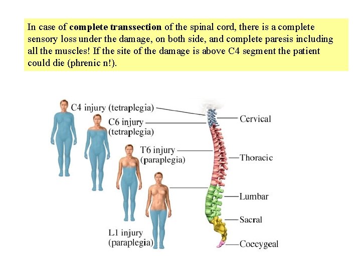 In case of complete transsection of the spinal cord, there is a complete sensory