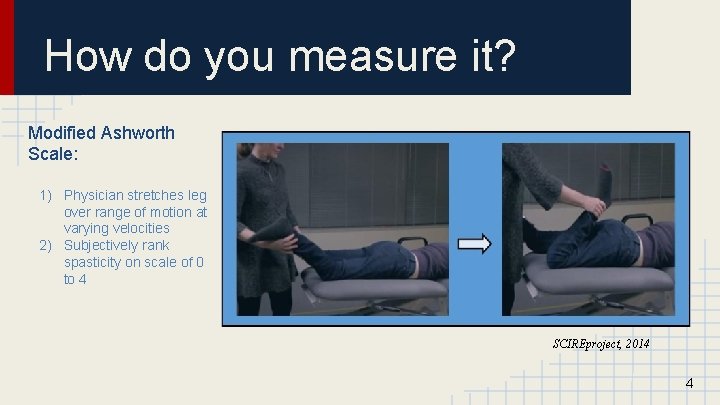 How do you measure it? Modified Ashworth Scale: 1) Physician stretches leg over range