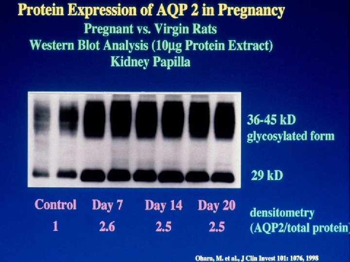 Protein Expression of AQP 2 in Pregnancy 