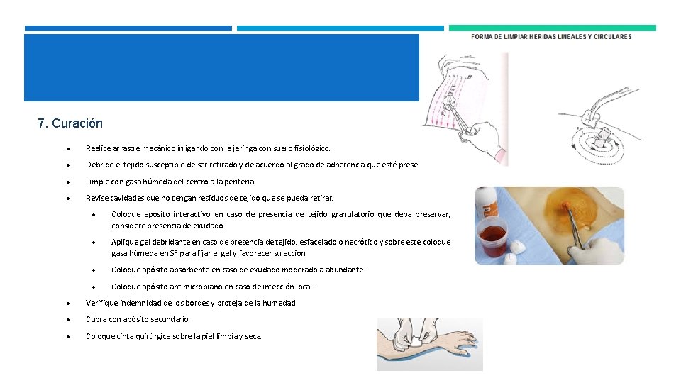 7. Curación Realice arrastre mecánico irrigando con la jeringa con suero fisiológico. Debride el