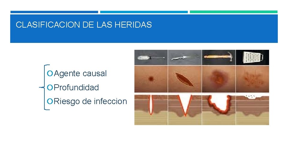 CLASIFICACION DE LAS HERIDAS Agente causal Profundidad Riesgo de infeccion 