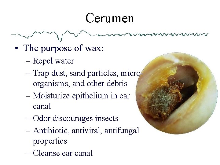 Cerumen • The purpose of wax: – Repel water – Trap dust, sand particles,