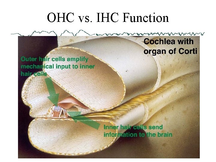 OHC vs. IHC Function 