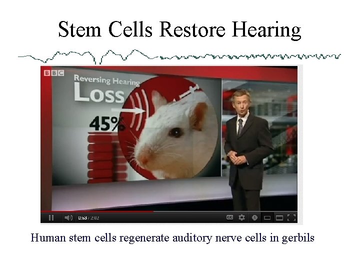 Stem Cells Restore Hearing Human stem cells regenerate auditory nerve cells in gerbils 