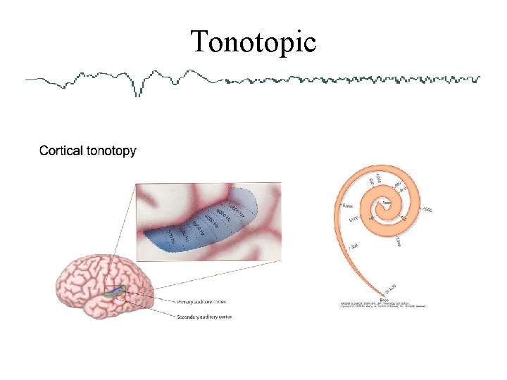 Tonotopic 