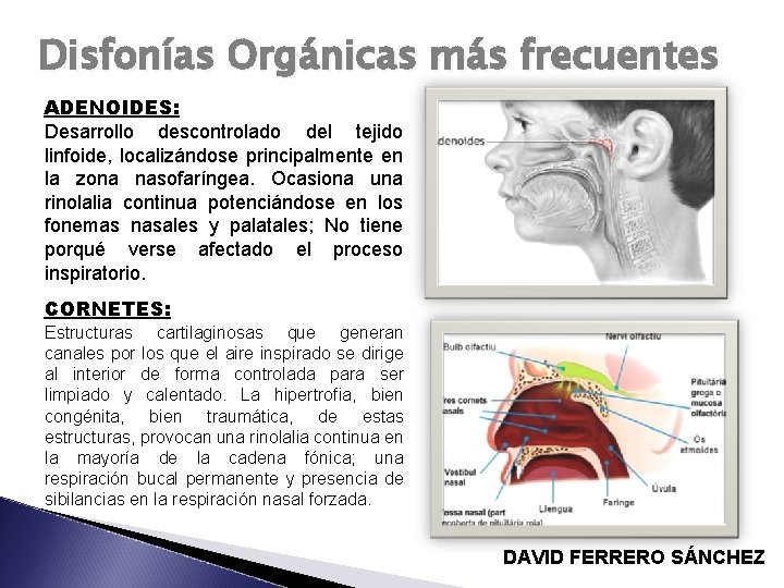 Disfonías Orgánicas más frecuentes ADENOIDES: Desarrollo descontrolado del tejido linfoide, localizándose principalmente en la