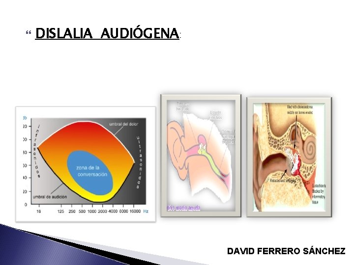  DISLALIA AUDIÓGENA: DAVID FERRERO SÁNCHEZ 