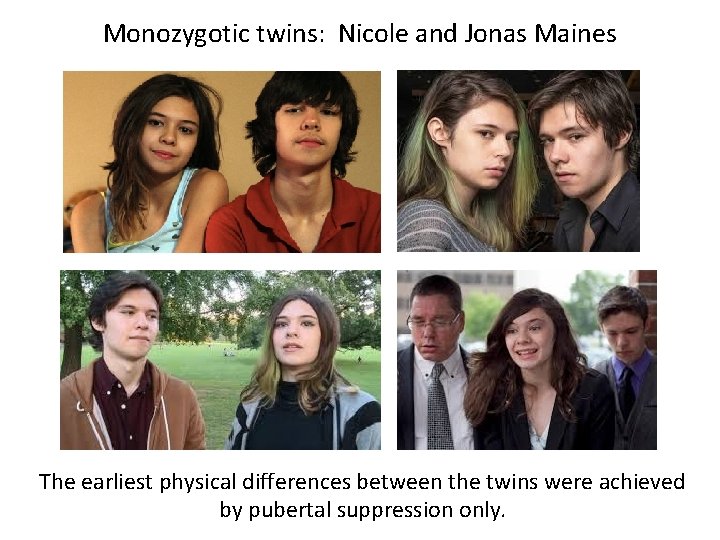 Monozygotic twins: Nicole and Jonas Maines The earliest physical differences between the twins were