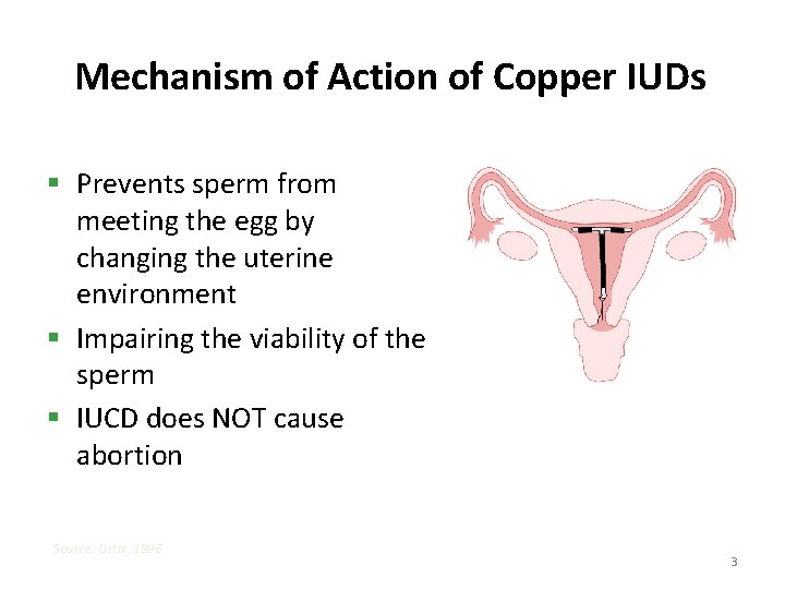 Mechanism of Action of Copper IUDs § Prevents sperm from meeting the egg by
