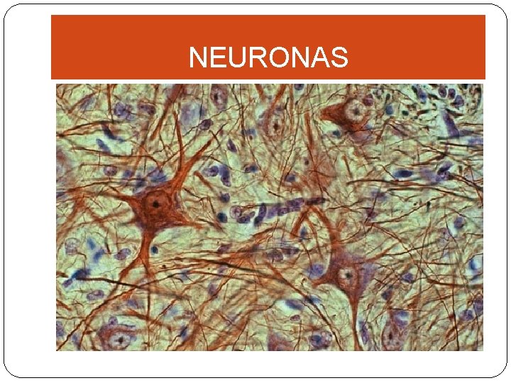 NEURONAS 