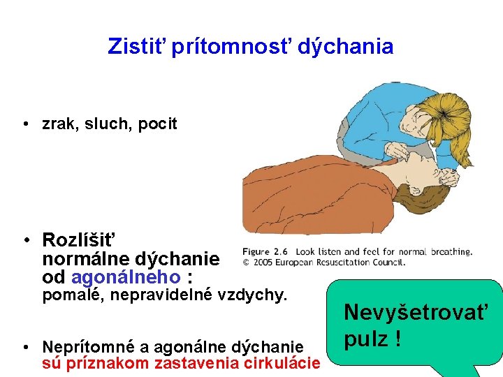 Zistiť prítomnosť dýchania • zrak, sluch, pocit • Rozlíšiť normálne dýchanie od agonálneho : Zistiť prítomnosť dýchania • zrak, sluch, pocit • Rozlíšiť normálne dýchanie od agonálneho :
