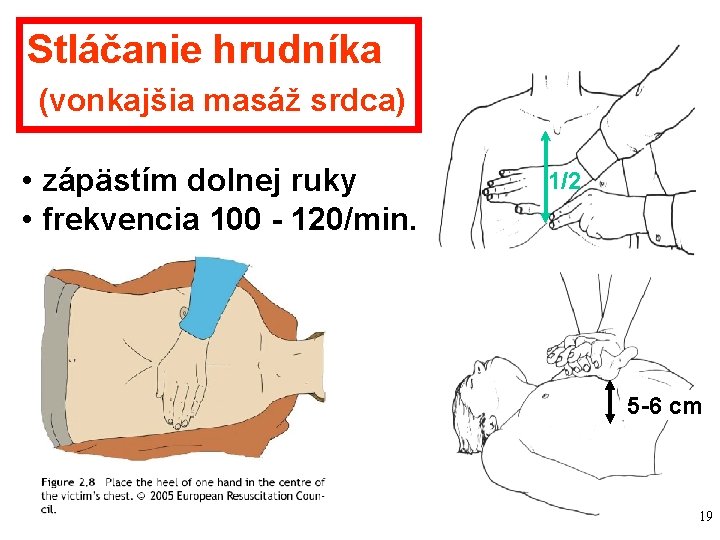 Stláčanie hrudníka (vonkajšia masáž srdca) • zápästím dolnej ruky • frekvencia 100 - 120/min. Stláčanie hrudníka (vonkajšia masáž srdca) • zápästím dolnej ruky • frekvencia 100 - 120/min.