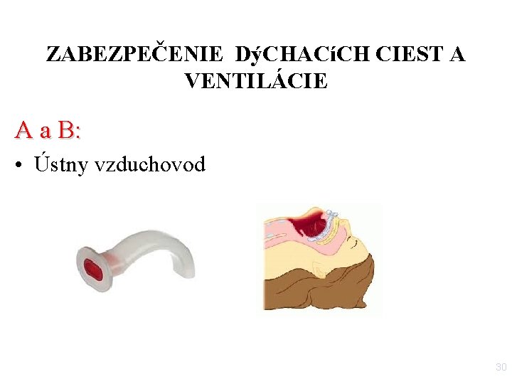 ZABEZPEČENIE DýCHACíCH CIEST A VENTILÁCIE A a B: • Ústny vzduchovod 30 