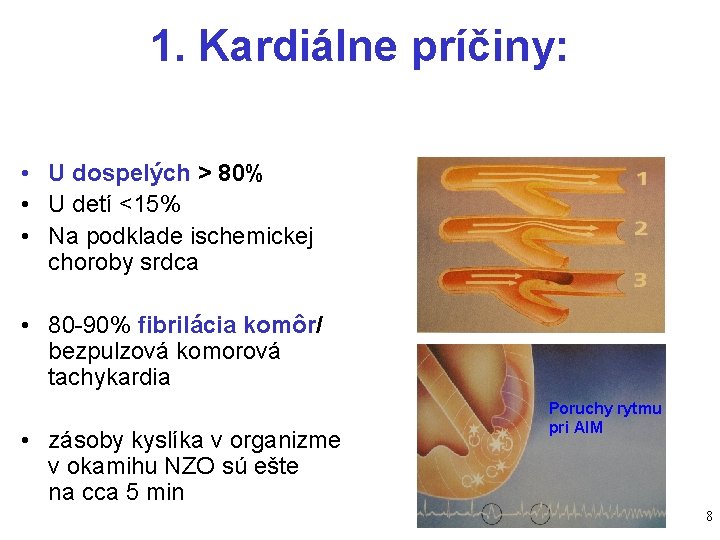 1. Kardiálne príčiny: • U dospelých > 80% • U detí <15% • Na 1. Kardiálne príčiny: • U dospelých > 80% • U detí <15% • Na