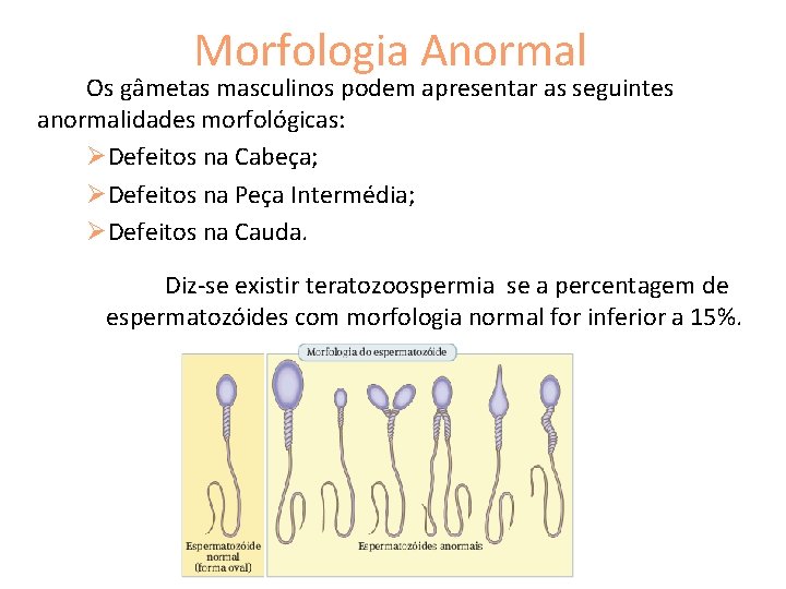 Morfologia Anormal Os gâmetas masculinos podem apresentar as seguintes anormalidades morfológicas: ØDefeitos na Cabeça;