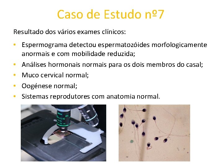 Caso de Estudo nº 7 Resultado dos vários exames clínicos: • Espermograma detectou espermatozóides